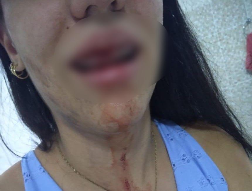 Jovem recebeu atendimento médico e medida protetiva (Foto: Divulgação / Jornal da Nova)