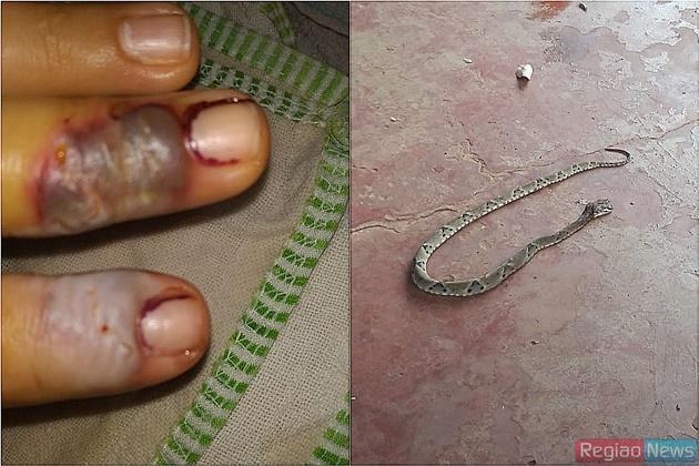 Mulher tem medo de perder mão (Foto: Região News)