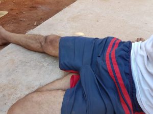 Homem atacado por pitbull conversa com o Midiamax sentado na calçada. Foto: Mariane Chianezi
