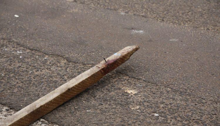 Jovem foi agredido com pedaço de pau com prego. (Foto: Leonardo de França)