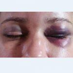 Mulher foi espancada por quatro horas (Foto: JP News)