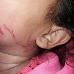 Menina ficou com ferimentos pelos rosto. (Foto: Dourados News)