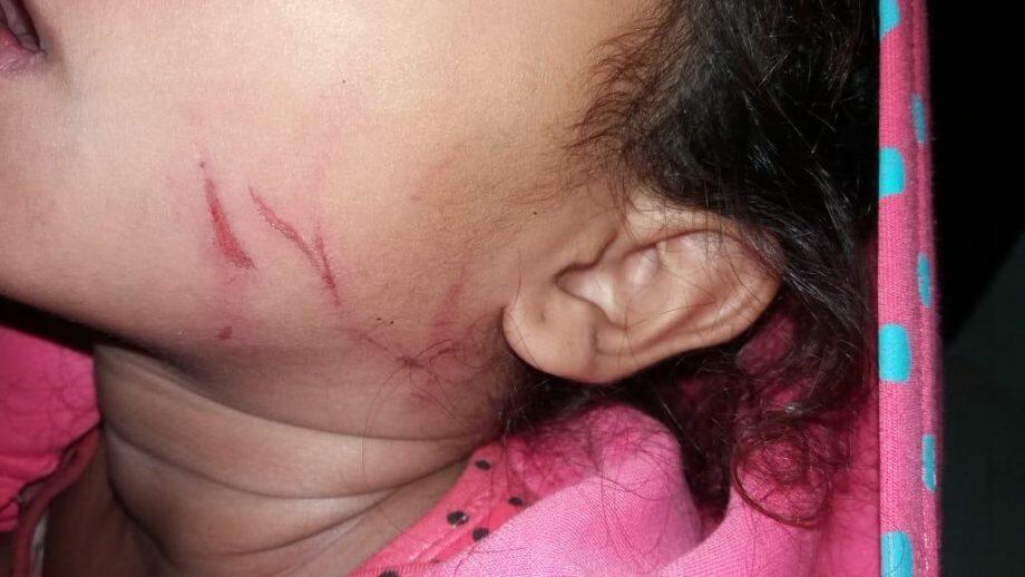 Menina ficou com ferimentos pelos rosto. (Foto: Dourados News)