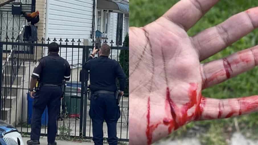 Policiais cercando o animal e mão do homem que foi atacado