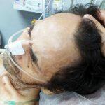 Cercilio precisa de uma cama hospitalar para que o tratamento possa ser feito da melhor maneira. (Foto: Divulgação/Leitor)