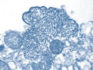 Partículas de vírus Nipah isolados da amostra de líquido cefalorraquidiano de uma pessoa infectada