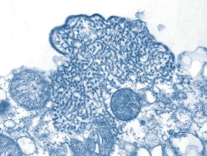 Partículas de vírus Nipah isolados da amostra de líquido cefalorraquidiano de uma pessoa infectada