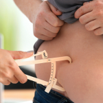Cirurgia bariátrica