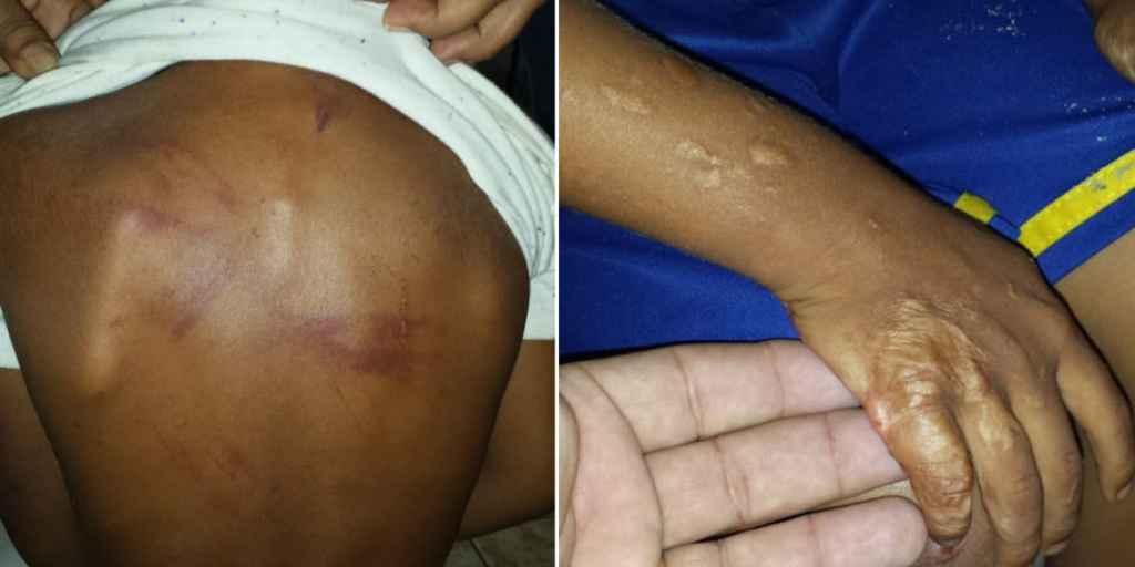 Menino tinha vários hematomas no corpo. Foto: Folha MS.
