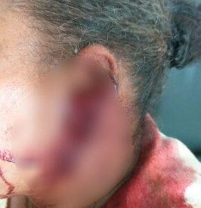 Mulher teve corte grande na orelha (Foto: Rio Brilhante em Tempo Real)