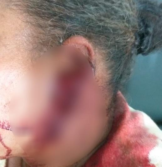 Mulher teve corte grande na orelha (Foto: Rio Brilhante em Tempo Real)