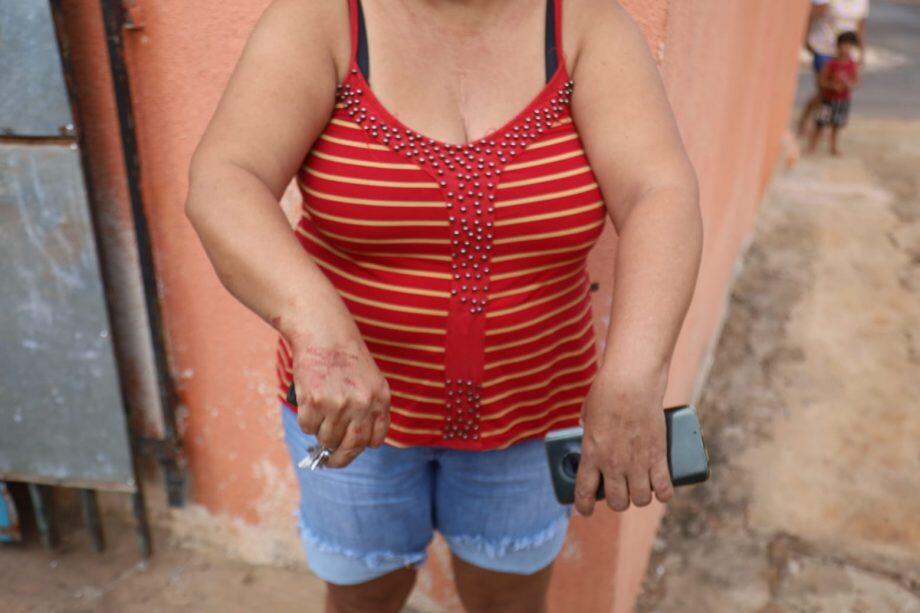 Mãe da vítima chamou filho ao ver animal sendo atacado.