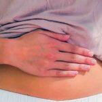 endometriose