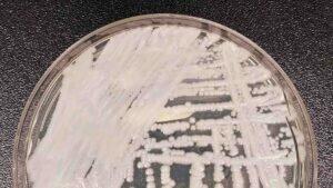 SP registrou caso de Candida auris. (CDC/Dr Leanor Hailey/Divulgação)