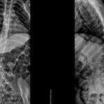 cirurgia