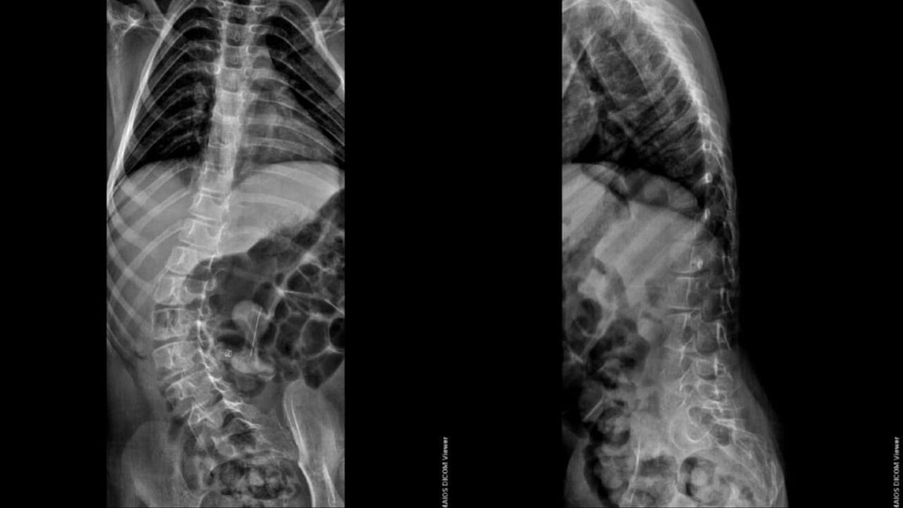 cirurgia