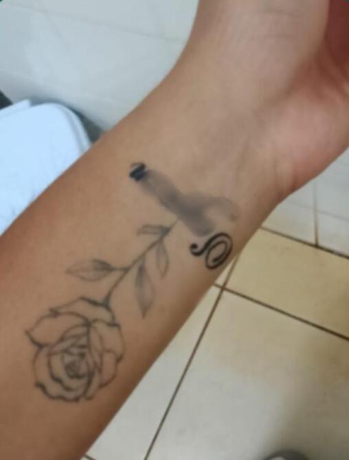 tatuou e se arrependeu