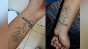 tatuou e se arrependeu