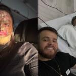 Xeroderma? Entenda sobre a doença rara que provocou a morte de influenciadora