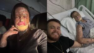 Xeroderma? Entenda sobre a doença rara que provocou a morte de influenciadora