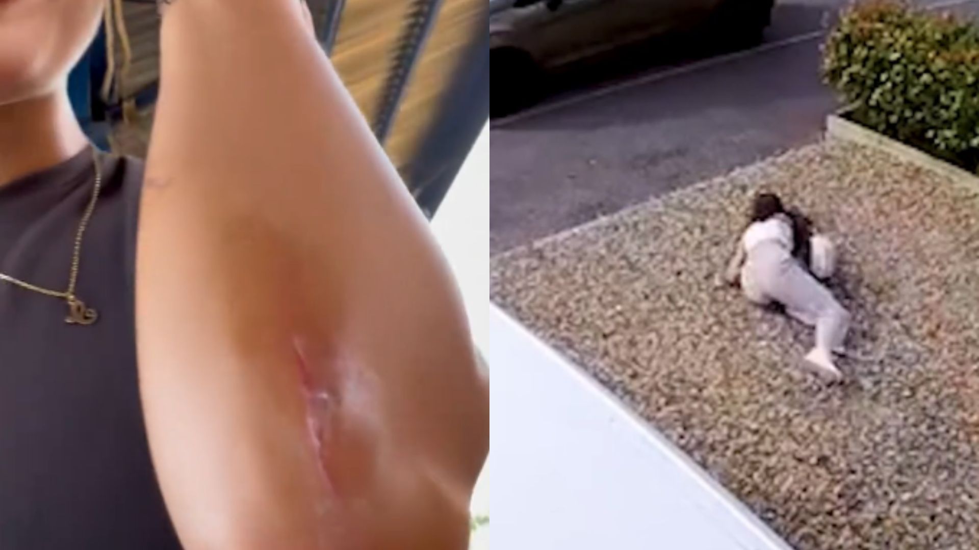 Perigosa? Calça da Zara viraliza nas redes após consumidoras relatarem quedas e ferimentos