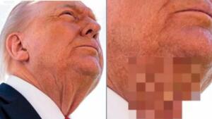 IA do Japão erra e censura pescoço de Trump como ‘conteúdo para adultos’
