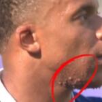 rosto de mbappe