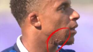 rosto de mbappe