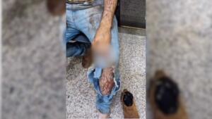 Morador diz ter sido atacado por onça enquanto trabalhava na colheita em Ponta Porã