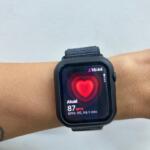 Monitoramento contínuo no pulso: até onde os alertas dos wearables devem preocupar?
