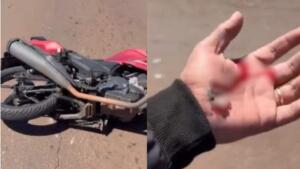VÍDEO: Motorista foge após ‘fechar’ motociclista e provocar acidente na Joaquim Murtinho