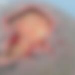 Mulher com deficiência é resgatada de casa com larvas na cabeça em Anastácio