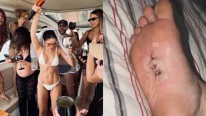 O que rolou? Juliette e amigos surgem cheios de hematomas após despedida de solteira