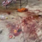 Comerciante esfaqueado por ladrão teve loja invadida 3 vezes: ‘Escapei da morte’