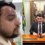 Assessor de Jair Renan é investigado por agredir primo após vitória de Lula