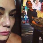 Ex de Luiza Brunet é condenado a pagar R$ 150 mil por agressão à modelo