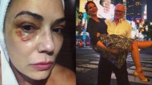 Ex de Luiza Brunet é condenado a pagar R$ 150 mil por agressão à modelo