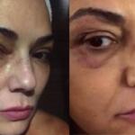 Dez anos depois, ex-marido de Luiza Brunet é condenado a pagar indenização por agredi-la: ‘Muito pouco’